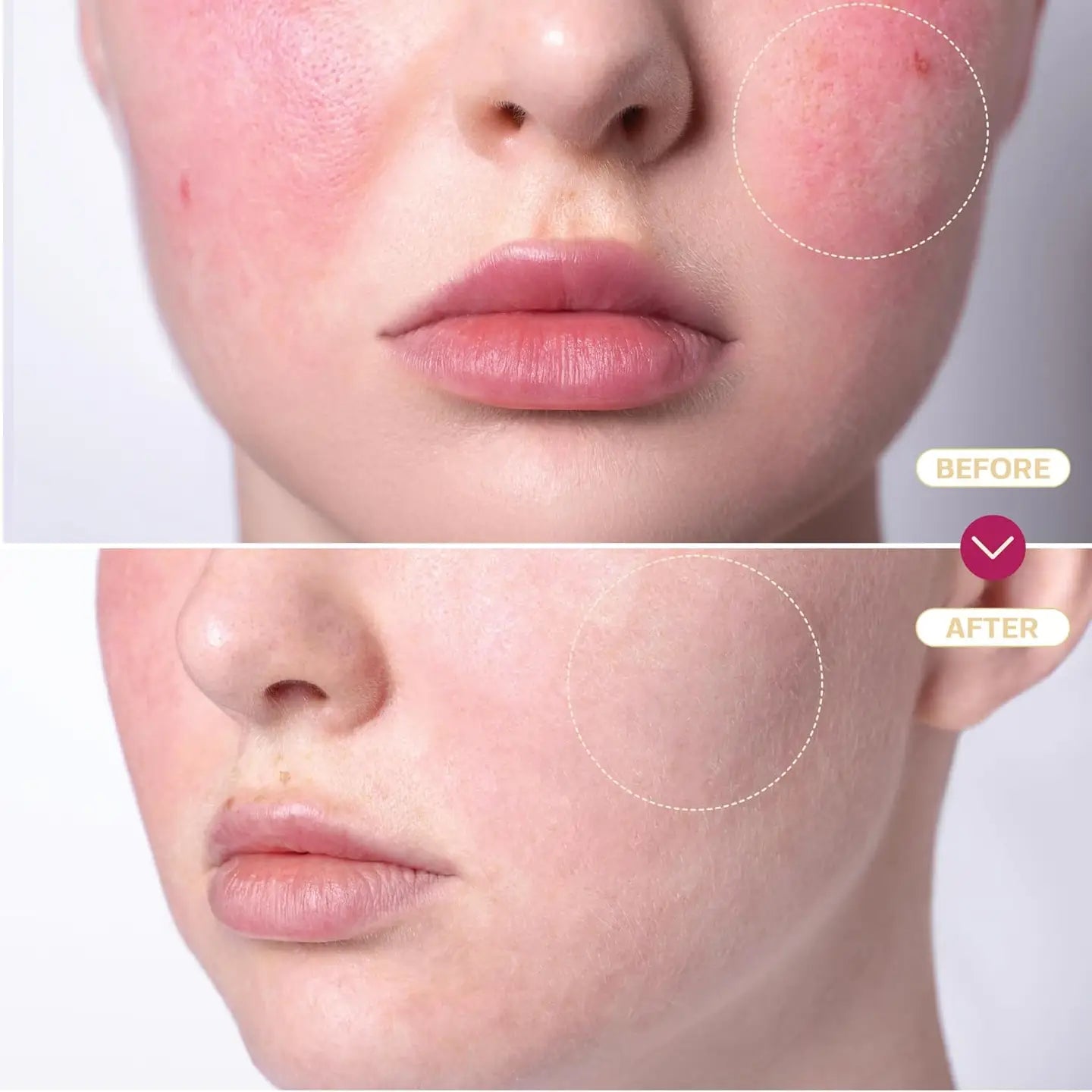 Hypochlorous Acid Spray for Skin & Face