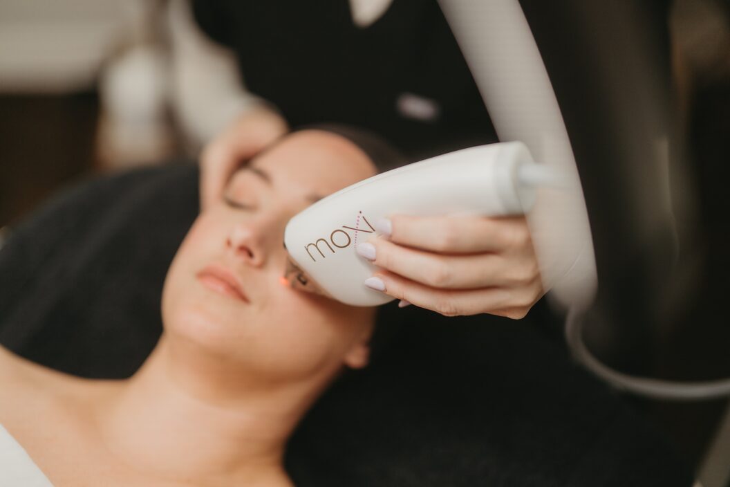 Is MOXI Lite the Right Laser Treatment for My Skin?