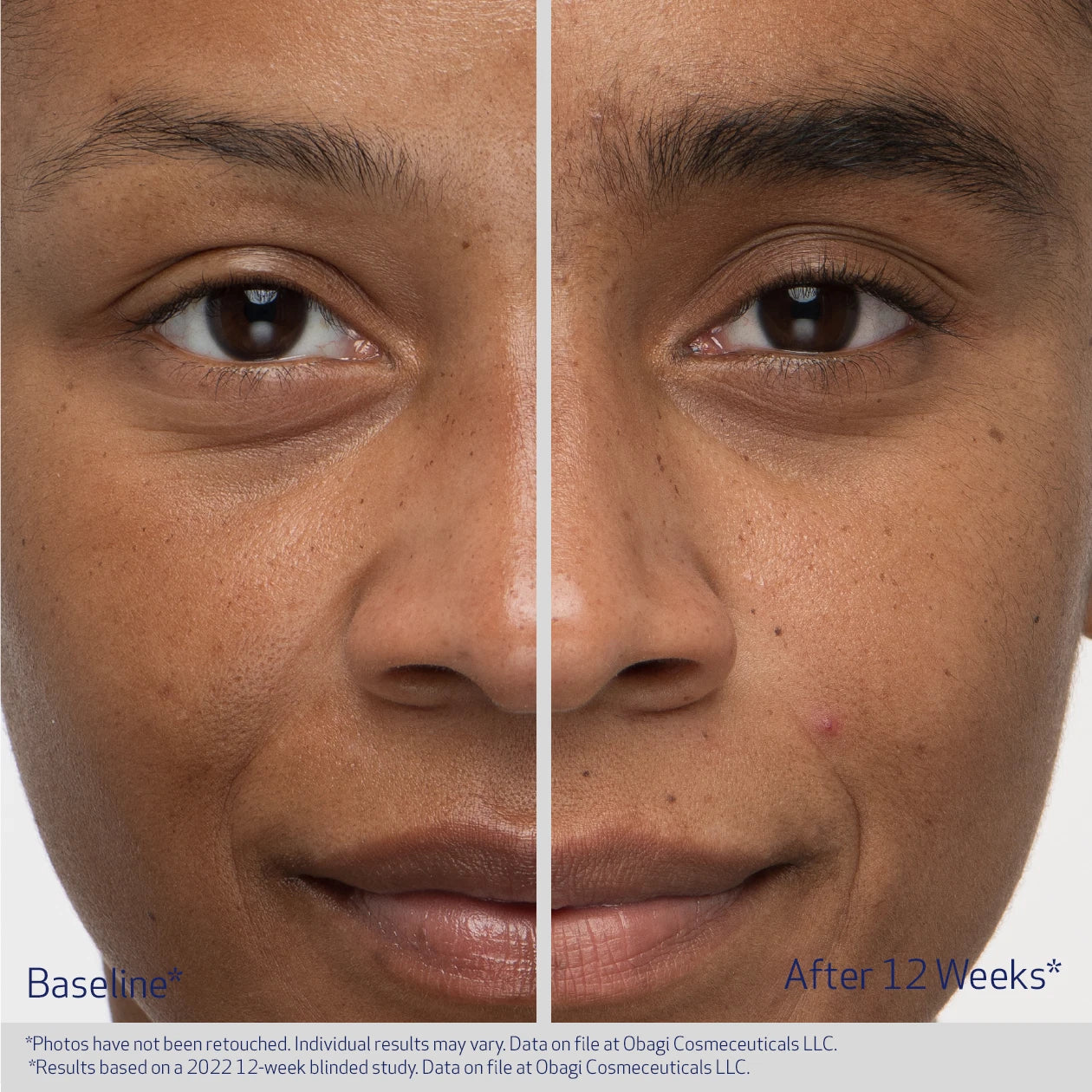 Eyebrow Boosting Serum