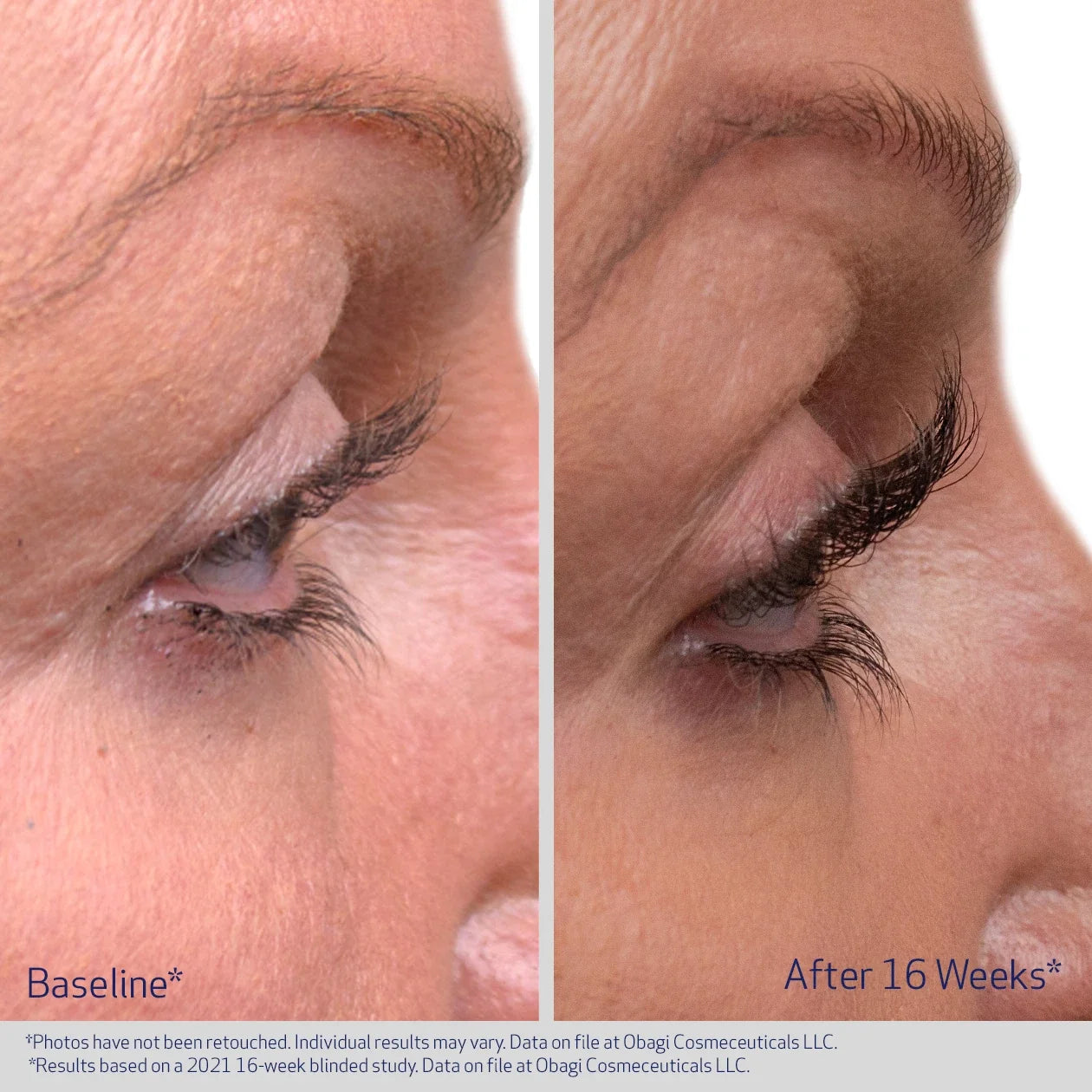 Eyelash Enhancing Serum