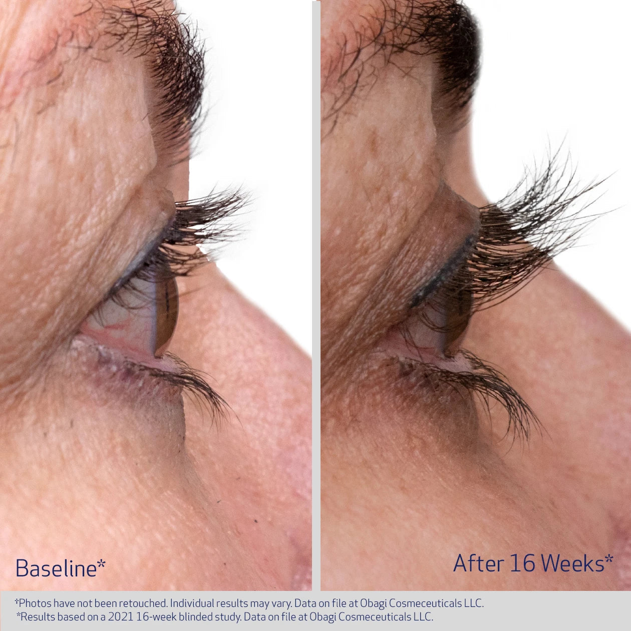 Eyelash Enhancing Serum