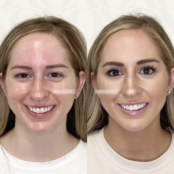 Expression Artistry™