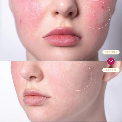 Hypochlorous Acid Spray for Skin &amp; Face